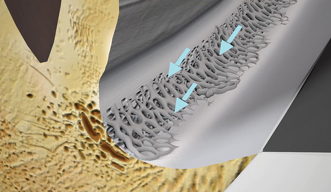 Relación entre biomecánica y glaucoma la malla trabecular