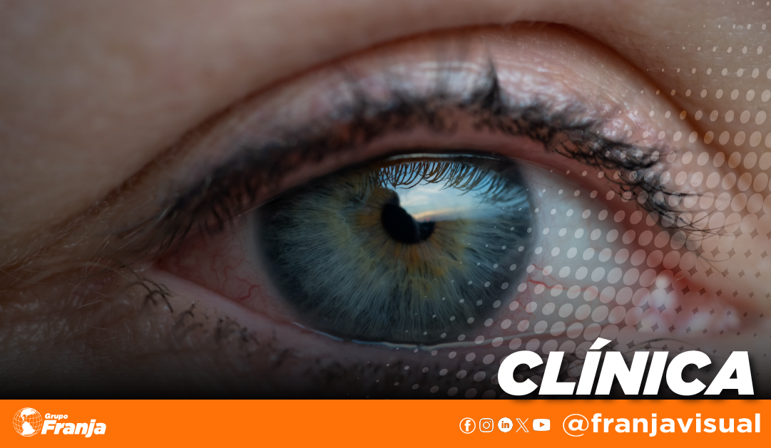 Ojo seco en la era digital