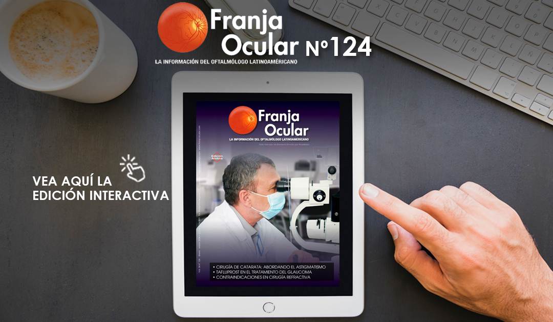 Revista Franja Ocular 124