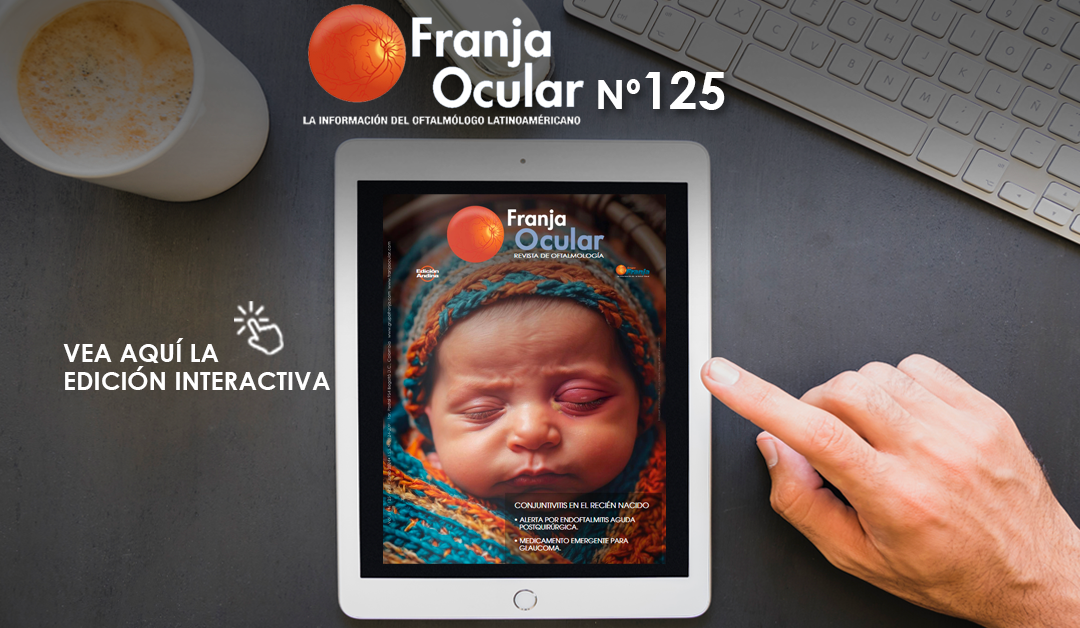 Revista Franja Ocular 125