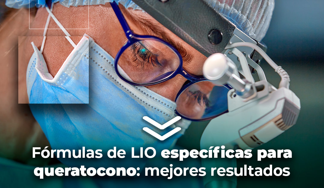 Boletín semanal: Fórmulas de LIO específicas para queratocono: mejores resultados