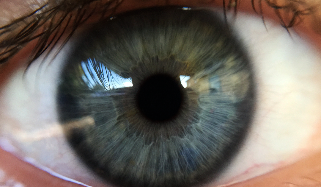 Disfunción de glándulas de Meibomio: pasado o presente