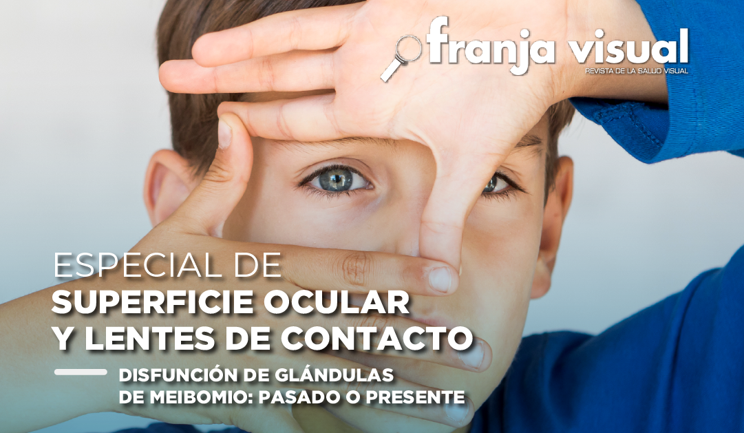 Especial: Disfunción de glándulas de Meibomio: Pasado o Presente