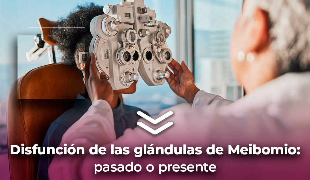Boletín semanal: Disfunción de las glándulas de Meibomio: pasado o presente