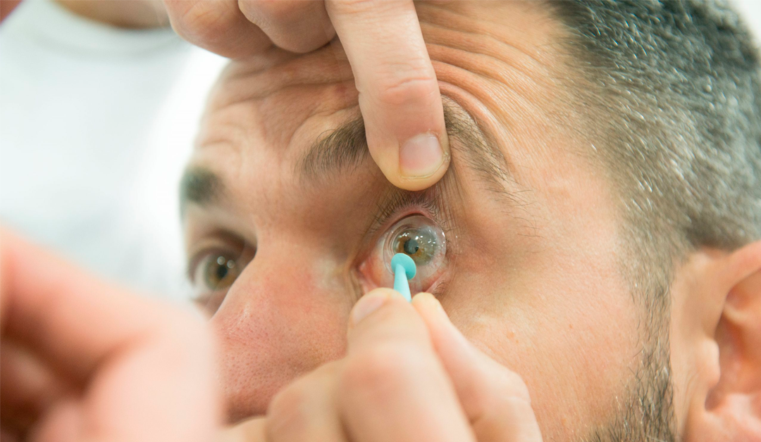 Innovación y creatividad en la mejora de la calidad visual