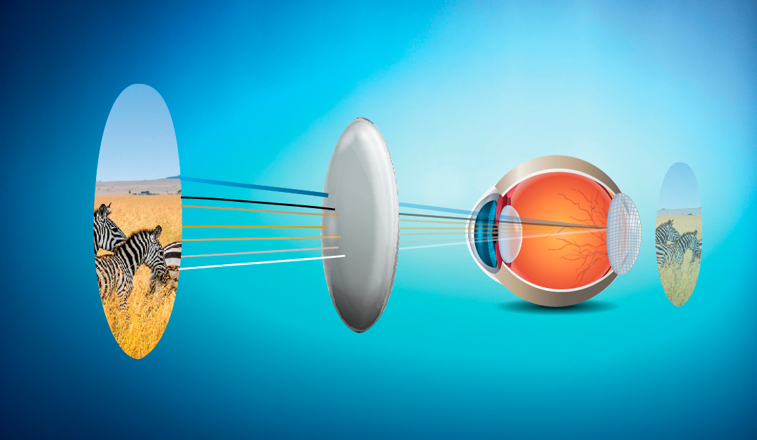 La teoría de modulación de contraste en el manejo de la miopía