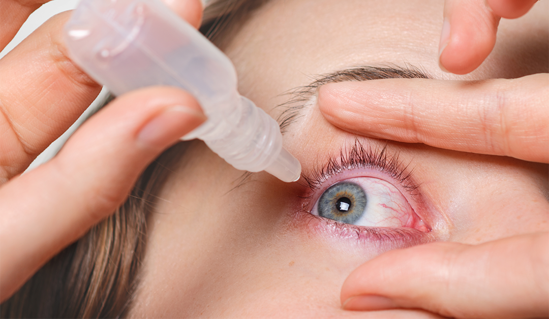 ScoutPro®: Innovación para el diagnóstico del ojo seco