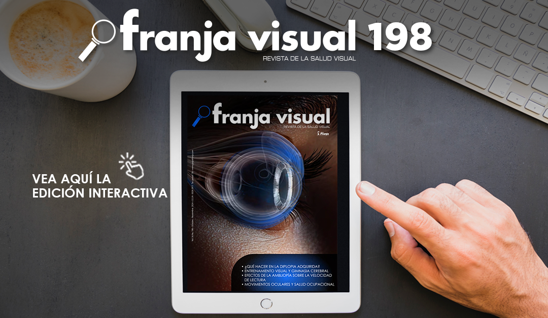 Franja Visual 198