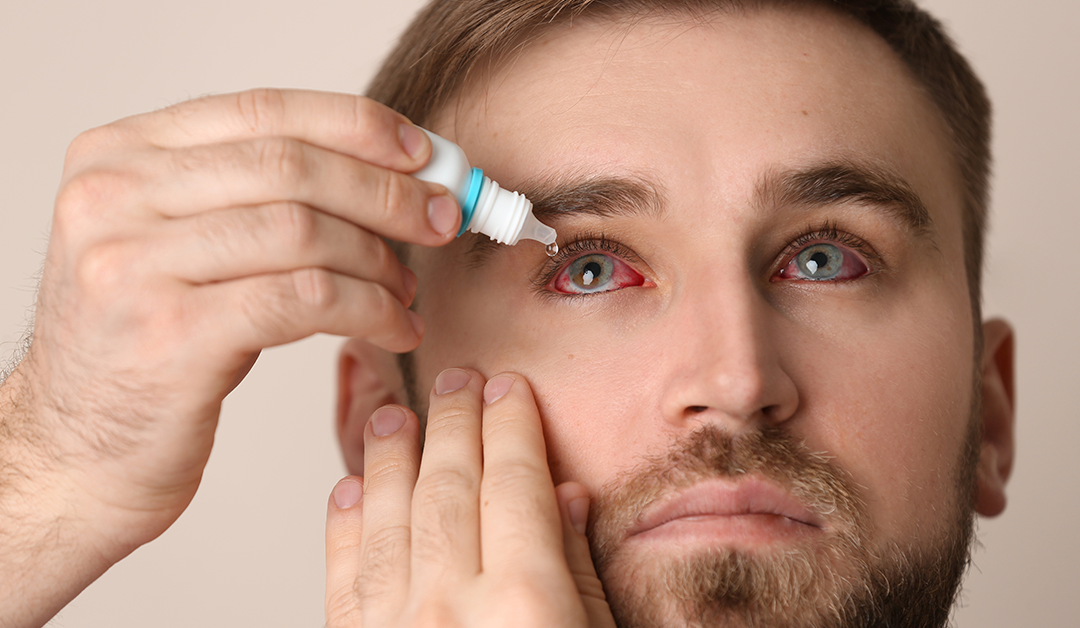 Recomendaciones para abordar la enfermedad de superficie ocular en el glaucoma