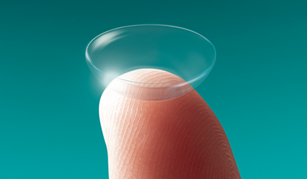 LC blando como medio de liberación sostenida de atropina para el manejo de la miopía