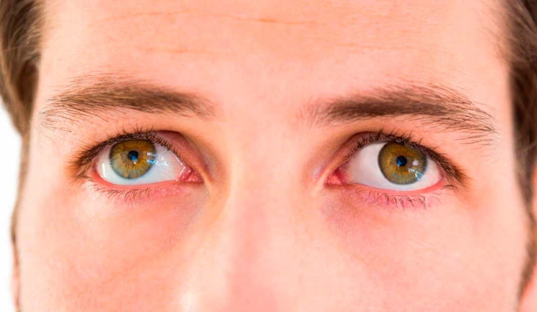 Más allá de la baja visión: el impacto multisensorial del nistagmo