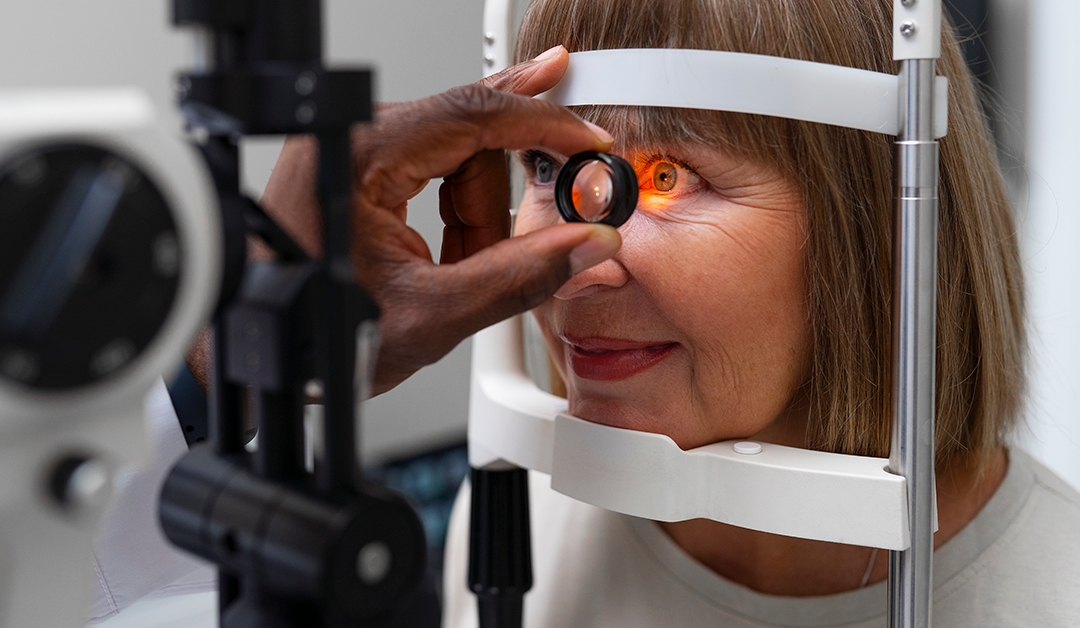 Glaucoma: Una amenaza silenciosa para la visión