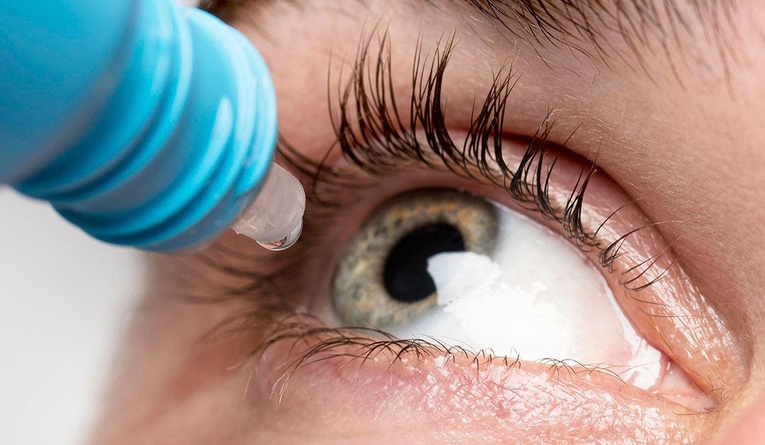 Avances en el tratamiento del ojo seco: el papel emergente de la nanofarmacología