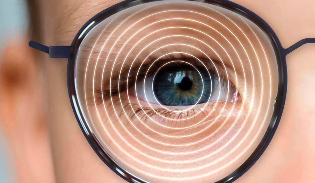 Intervención en niños premiopes con hipermetropía baja: prevención de la miopía