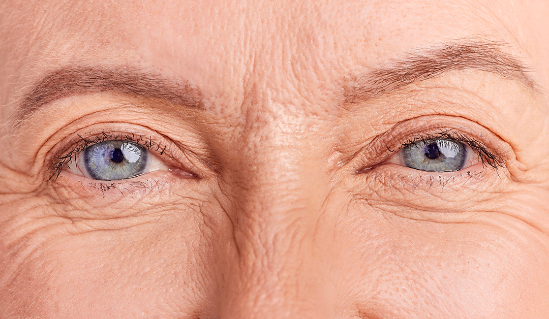 Carcinoma de glándulas Sebáceas. Un tumor que merece atención