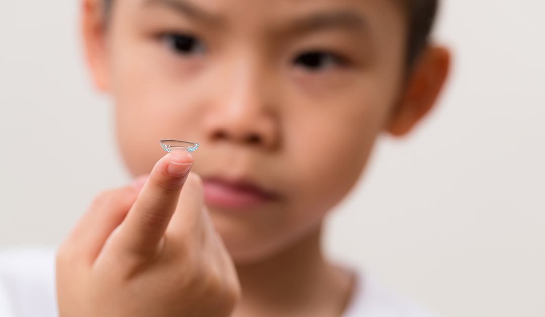 Lentes de contacto: una herramienta clave en el control de la miopía infantil