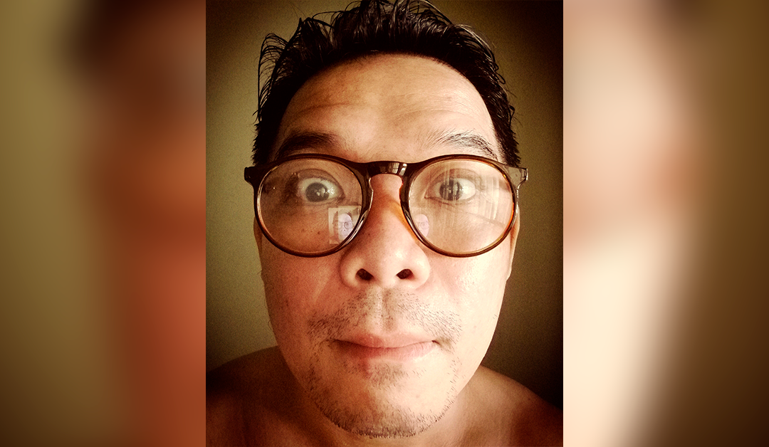 La miopía desencadena “síndrome de ojo pesado”