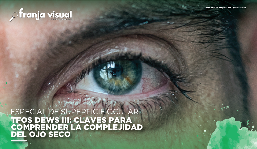 Especial Superficie Ocular