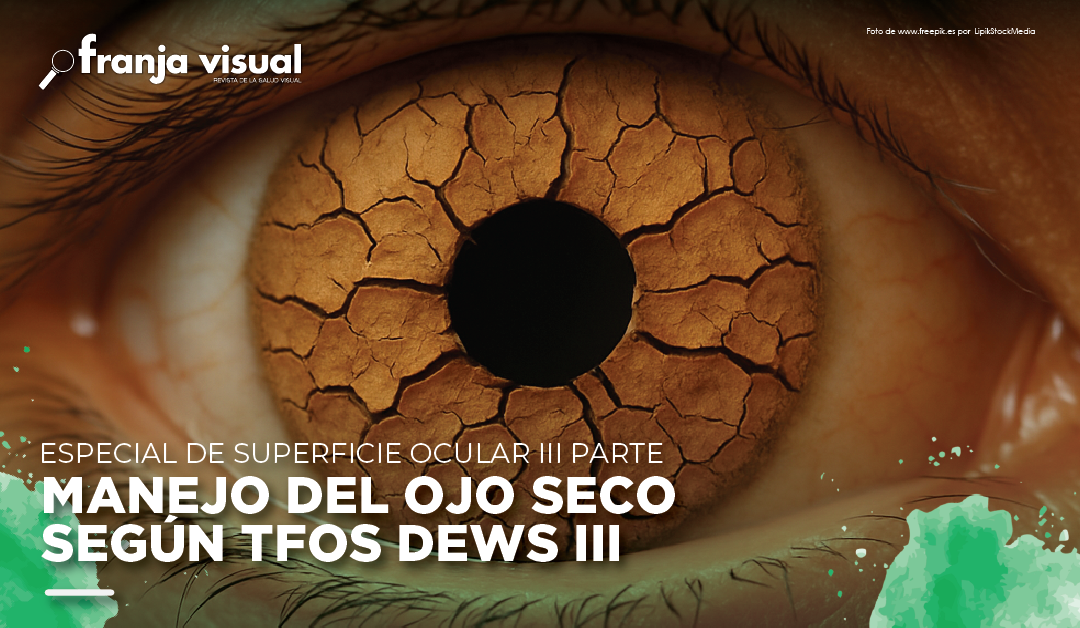 TFOS DEWS III: Enfoque Actual para el Manejo del Ojo Seco.